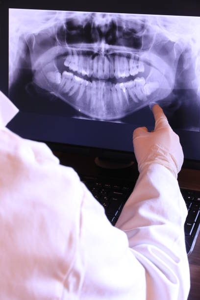 Best Emergency Dentist for Lost Fillings or Crowns in Hayti, MO